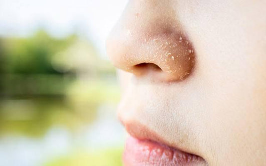 Tips To Address Dry, Flaky Skin Around Your Nose