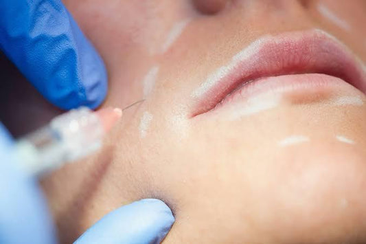 Dissolve and Refresh: The Ultimate Guide to Filler Dissolving Treatments