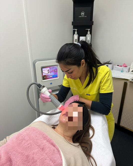 What is RF Microneedling and How Can It Help Your Skin?