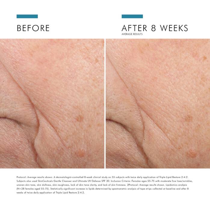 Triple Lipid Restore 242 Anti-Ageing Moisturiser