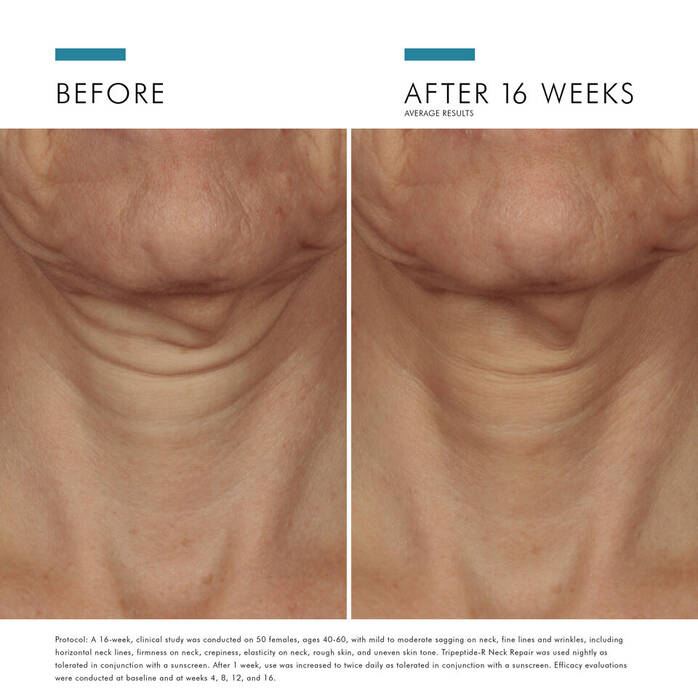 Tripeptide-R Retinol Neck Repair Cream