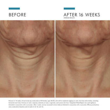 Tripeptide-R Retinol Neck Repair Cream